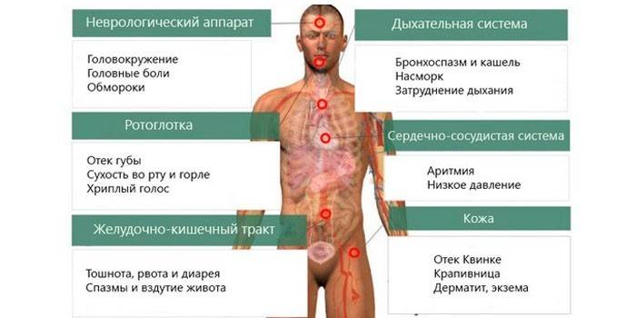 Objawy alergii