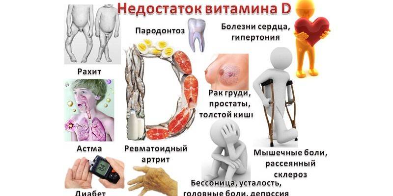Doenças por Deficiência de Vitamina D