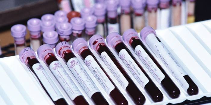 Tubos de teste de sangue