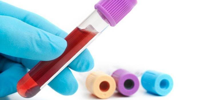 Sangue in vitro para análise.