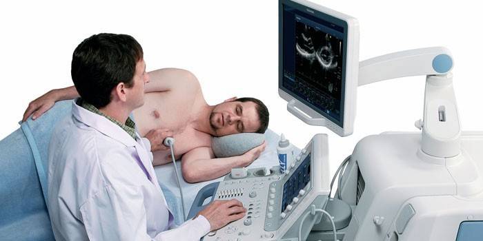 Ultrazvuk srdca