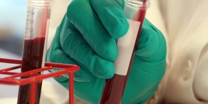 Skúmavka s krvným testom v ruke laboratórneho asistenta
