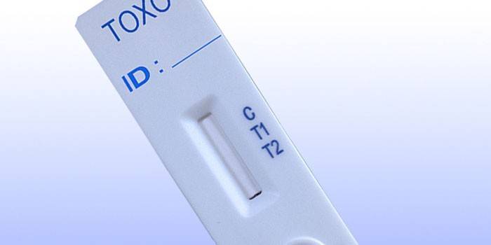 Toxoplazma IgM