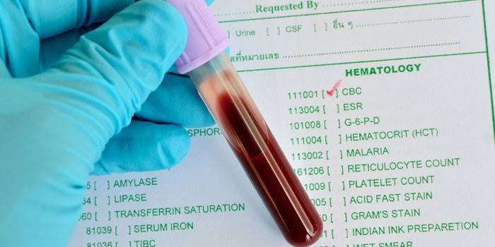 Krvný test in vitro