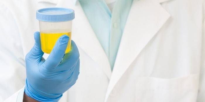 Médico segura na mão um recipiente com urina