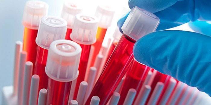Krvné testy in vitro