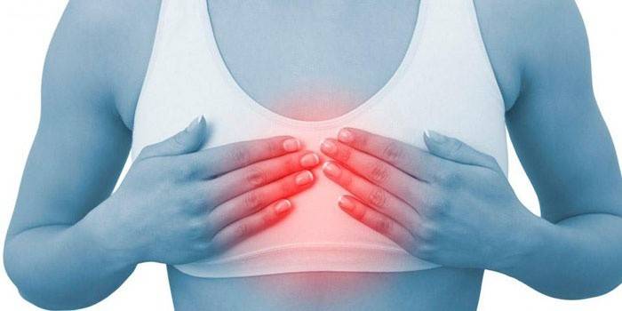 Dolor en el área del pecho de una mujer.