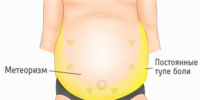 Gran barriga hinchada