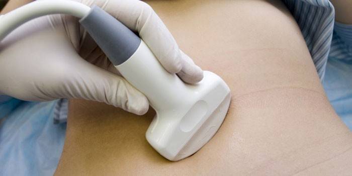 Ultrasonido del abdomen