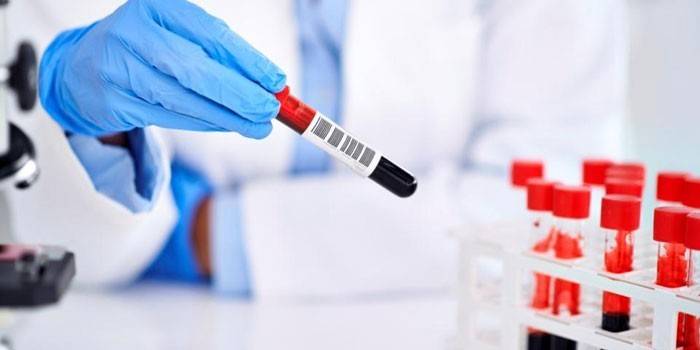 Badania krwi in vitro