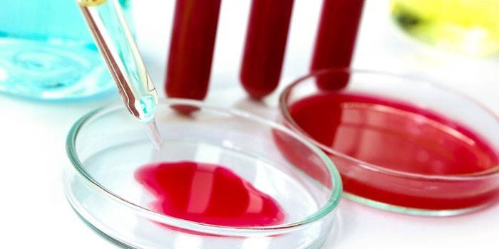 Sangue em placas de Petri