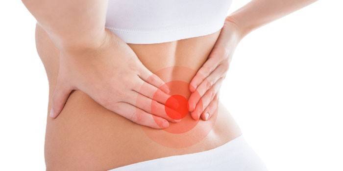 Dolor en la región lumbosacra de una mujer.