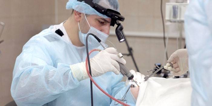 Cirurgião para cirurgia de remoção de adenoide