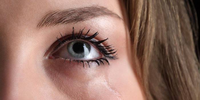 A menina tem olhos lacrimejantes