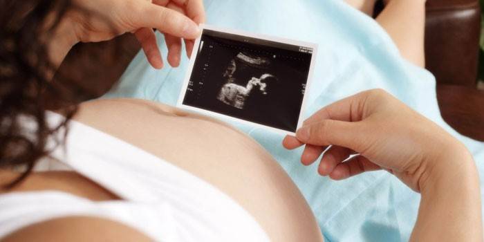Tehotná žena sa pozerá na ultrazvukové vyšetrenie