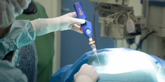 Medyk przeprowadza laserowe odparowanie prostaty