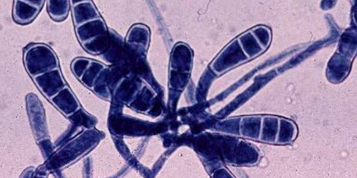 Fungus Epidermophyton floccosum