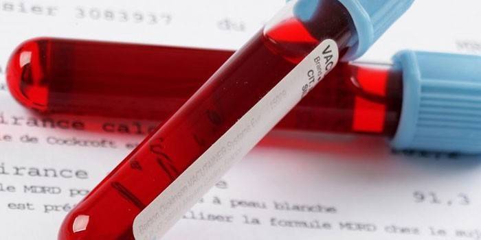 Testes de sangue in vitro