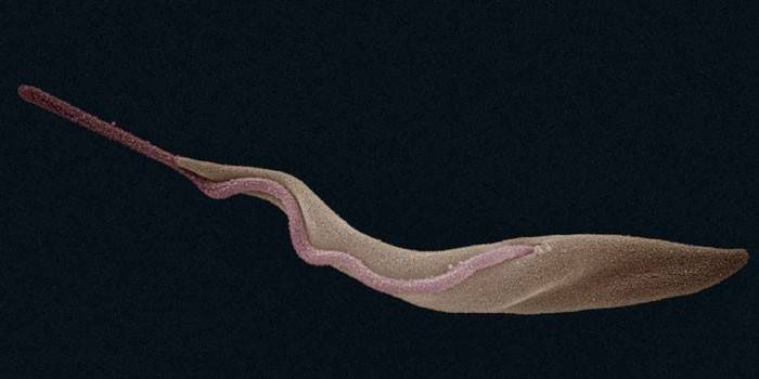 O agente causador de Trypanosoma brucei rhodesiense
