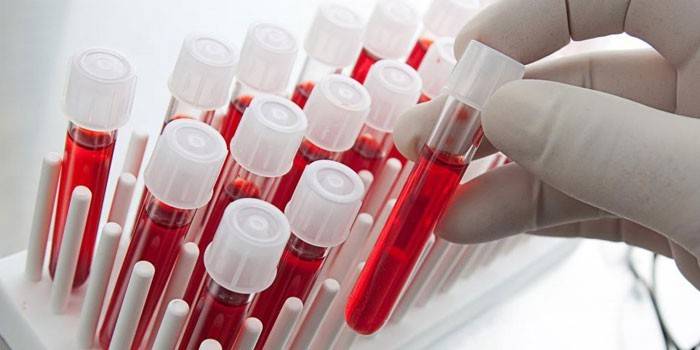 Testes de sangue in vitro