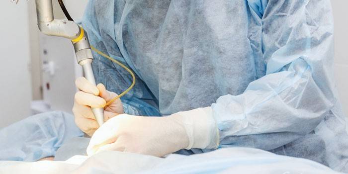 Remoção de Lipoma Cirúrgico