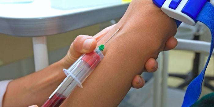 Amostragem de sangue de uma veia
