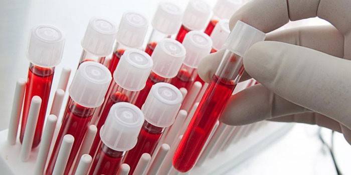 Teste de sangue do tubo de ensaio