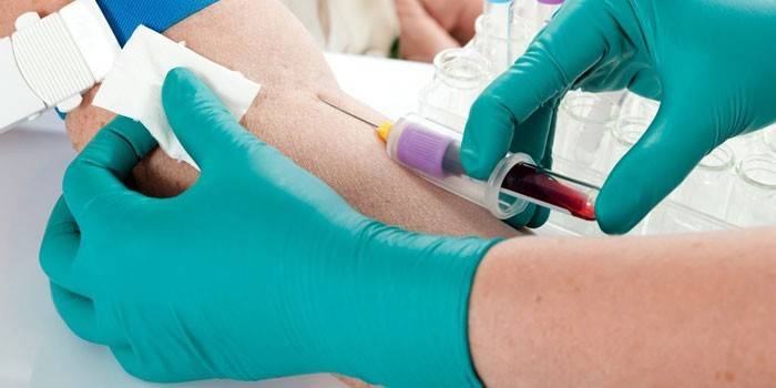 Amostragem de sangue de uma veia