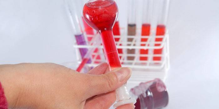 Análisis de sangre in vitro