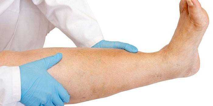Médico examina a perna de um paciente