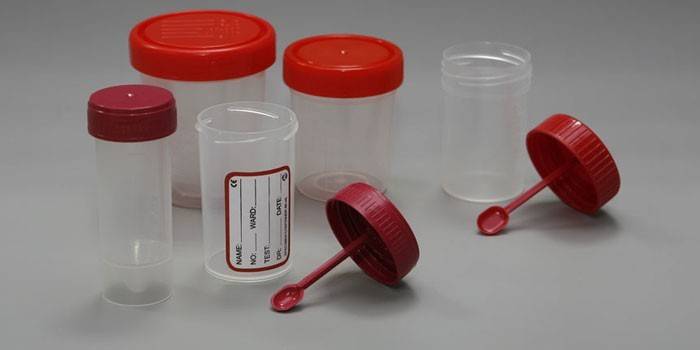 Recipientes de análise