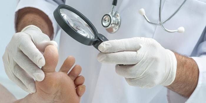 Diagnostika plesňových húb