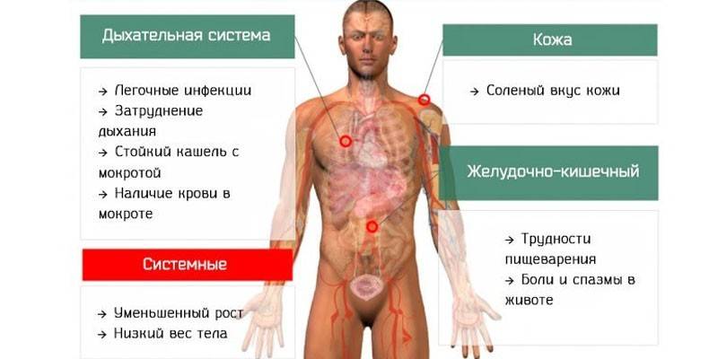 Sintomas de fibrose cística