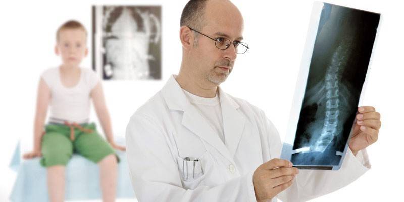 Diagnóstico de escoliosis en niños.