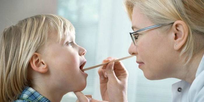 Un médico examina la cavidad bucal de un niño.