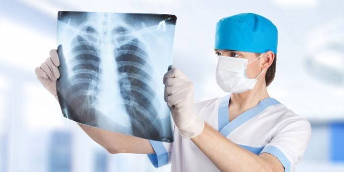 El doctor observa una radiografía de los pulmones.