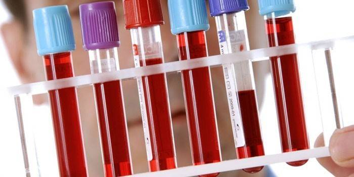 Prueba de sangre