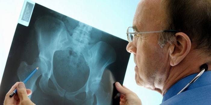 Medic pri pohľade na röntgen