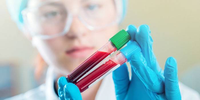 Laboratórna krv v rukách laboratórneho asistenta