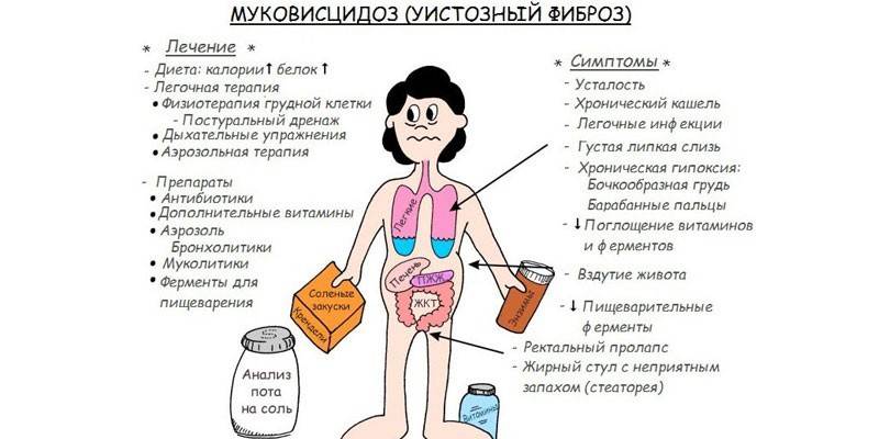 Sintomas e tratamento da fibrose cística em adultos