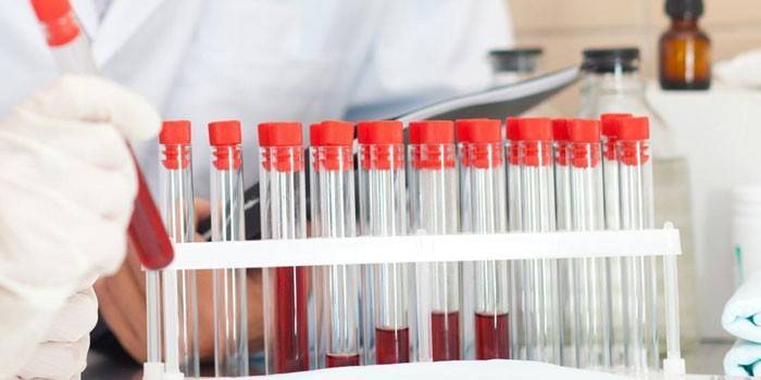 Krvné testy in vitro