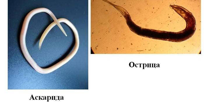 Lombriga e pinworm