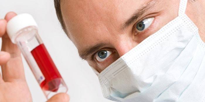 El médico observa un tubo de ensayo con sangre.