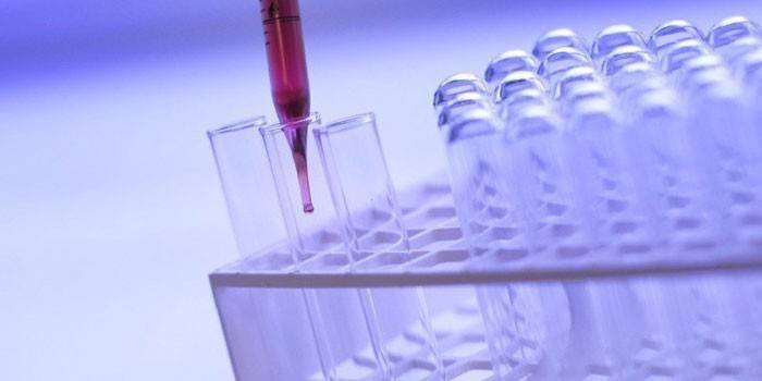 Prueba de sangre