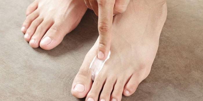 Un hombre aplica ungüento a la piel entre los dedos de los pies.