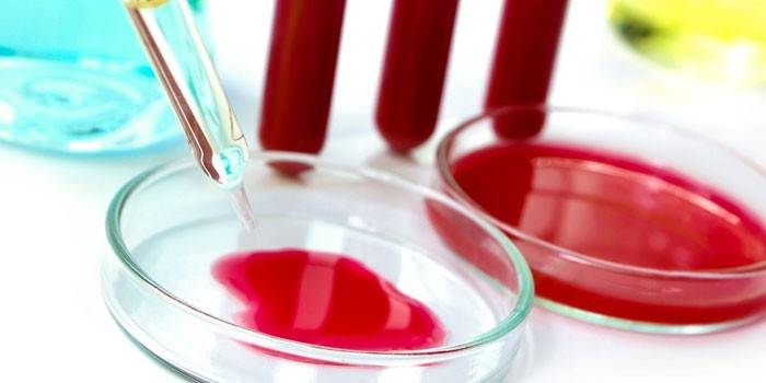 Exames de sangue em uma placa de Petri e tubos de ensaio
