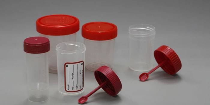 Recipientes de análise fecal