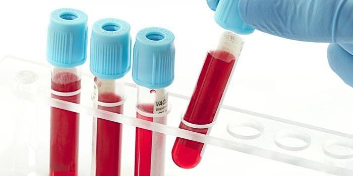 Testes de sangue in vitro