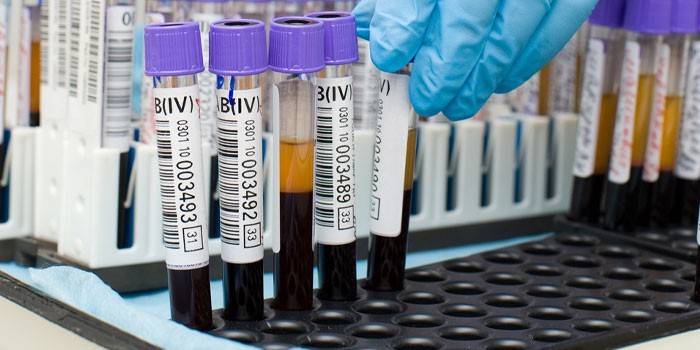 Badania krwi in vitro