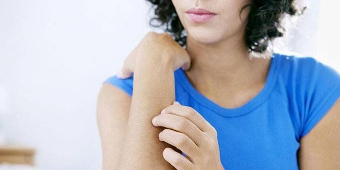 La niña se rasca la piel de la mano.